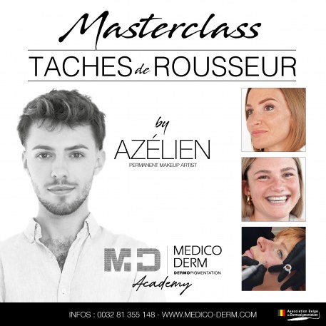 Formation Taches Rousseur